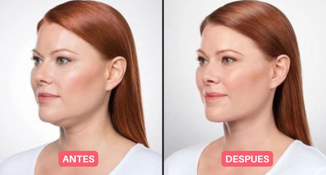 VisageSlim moldeador facial